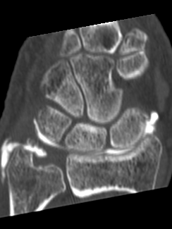 MRI & CT